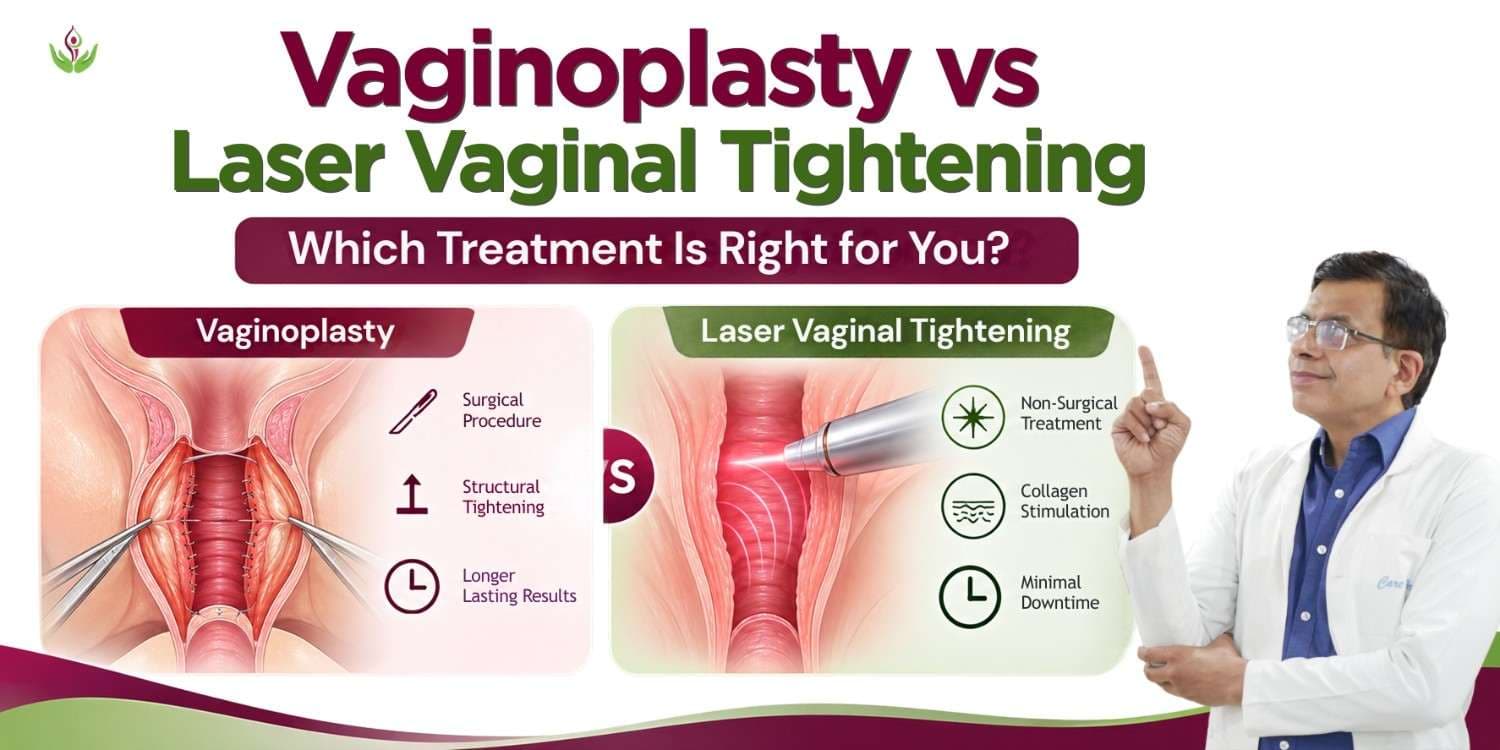 Vaginoplasty vs Laser Vaginal Tightening