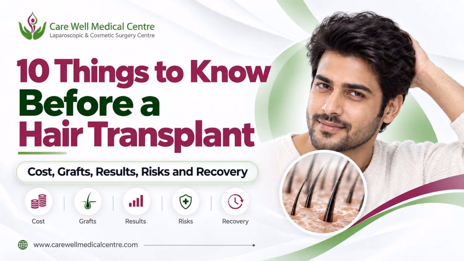 10 Things to Know Before a Hair Transplant