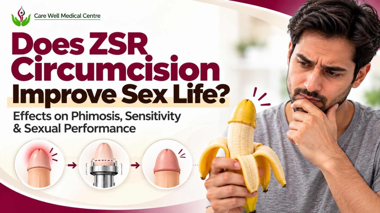 Does ZSR Circumcision Improve Sex Life