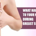 Nipples reshaping during breast reduction surgery, showcasing changes and recovery process.