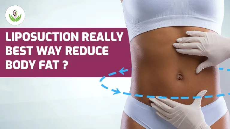 Is Liposuction Really Best Way To Reduce Body Fat?