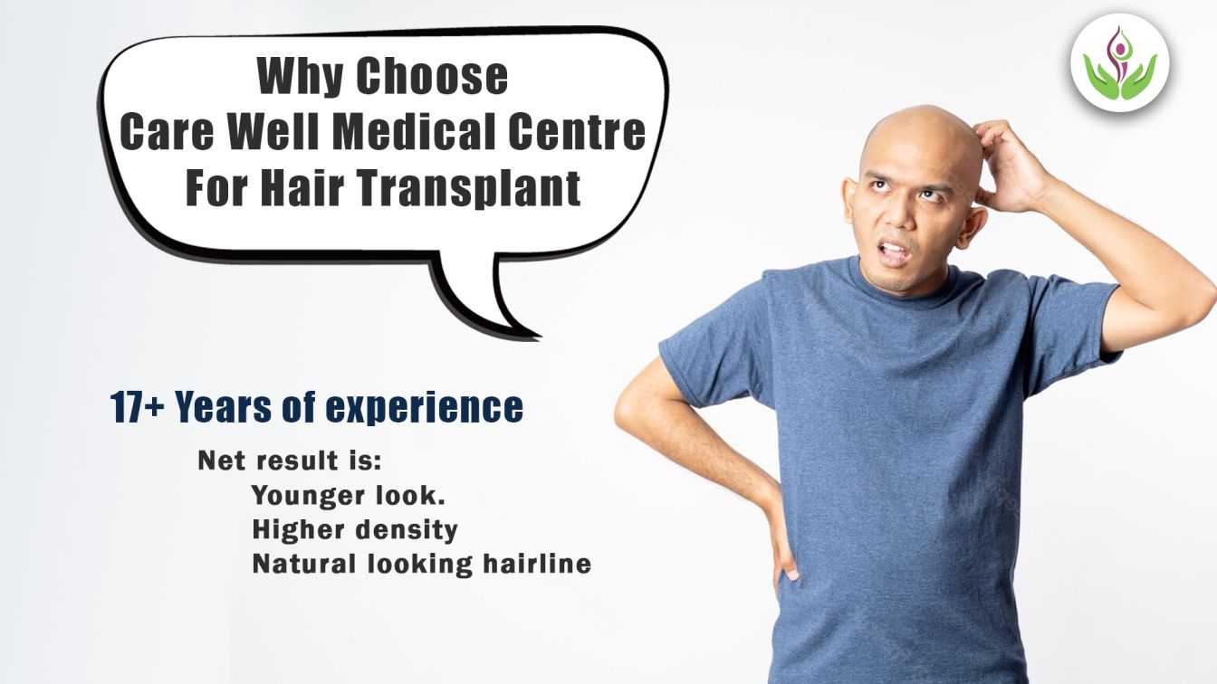 Best Hair Transplant Clinic in Delhi, Bollywood And Cricket Celebrities who underwent Hair Transplant hair transplant cost in delhi, hair loss treatment in delhi, hair transplant treatment in delhi, prp treatment in delhi