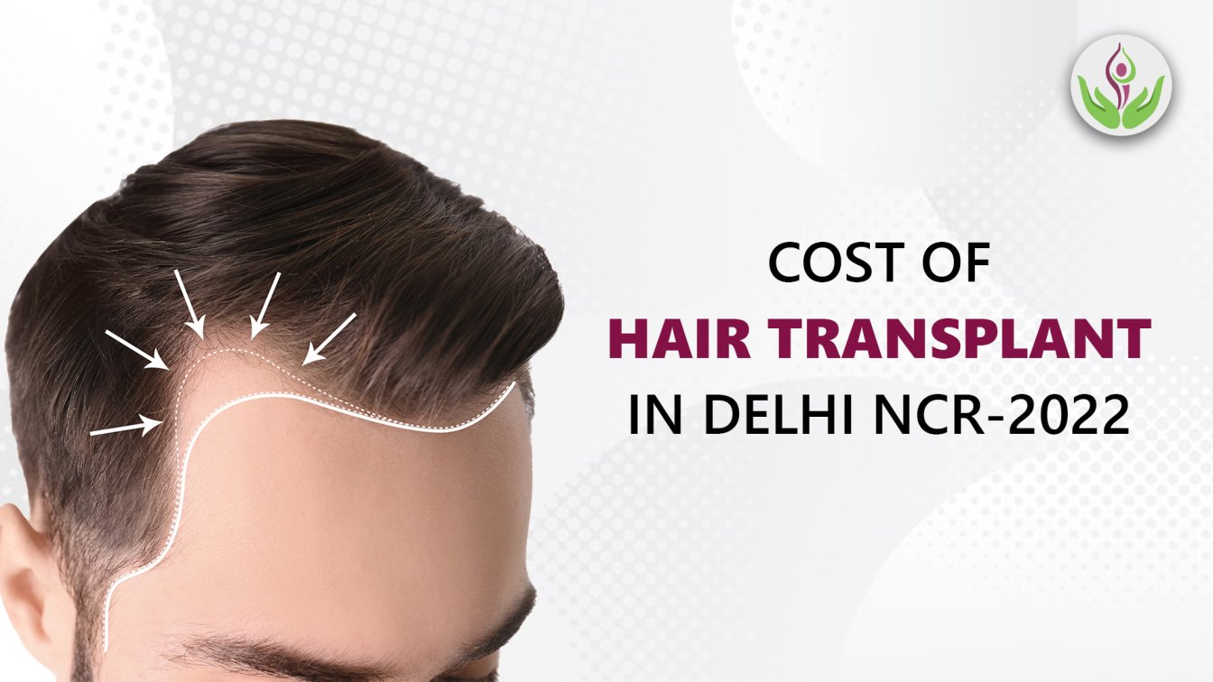 Hair Transplant Cost In Delhi NCR 2022 - Might Surprise You