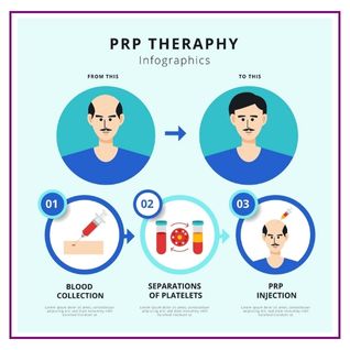 Procedure for PRP Treatment For Hair loss