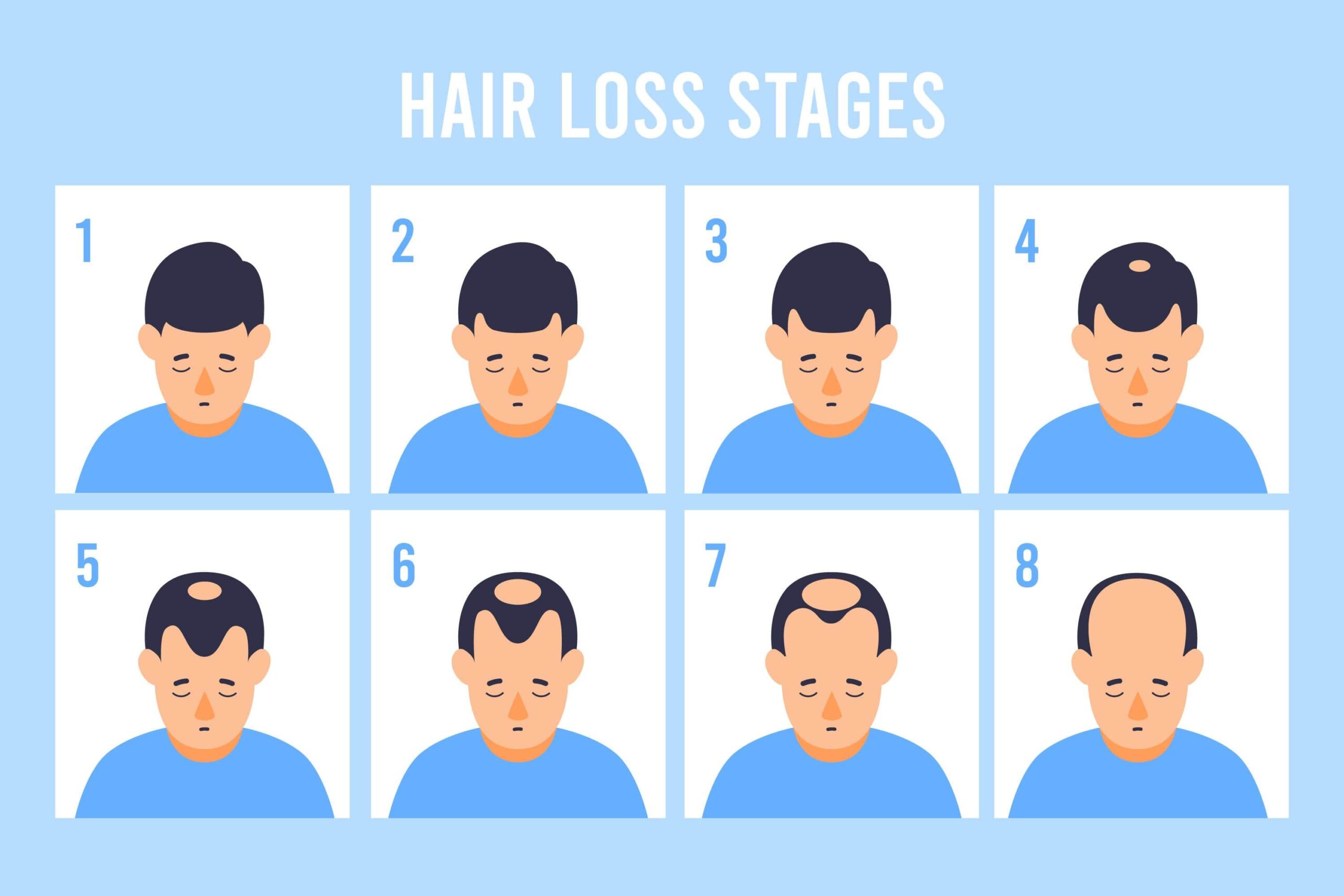different stages of hair loss