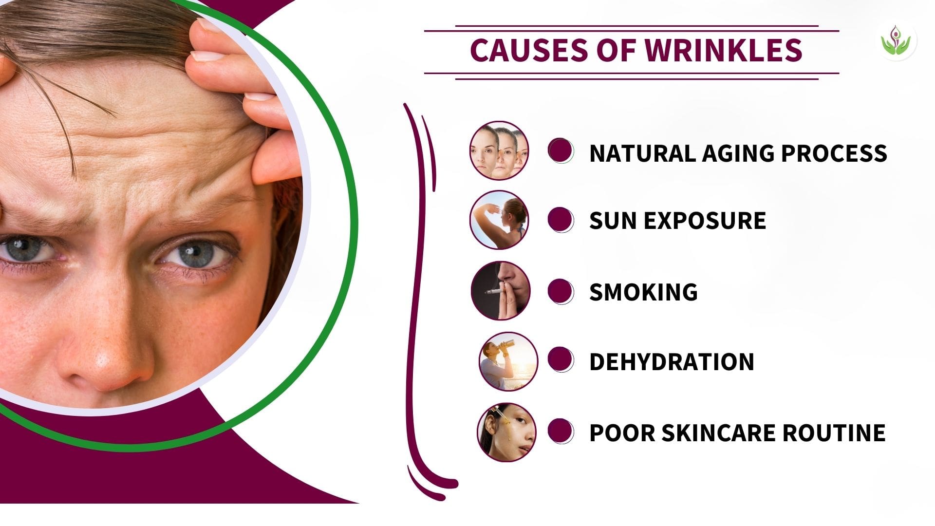 Causes of Wrinkles