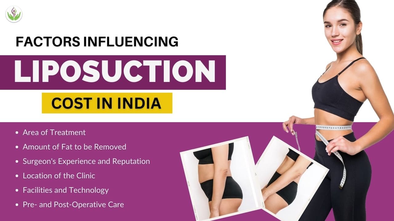 Factors Influencing Liposuction Cost in India