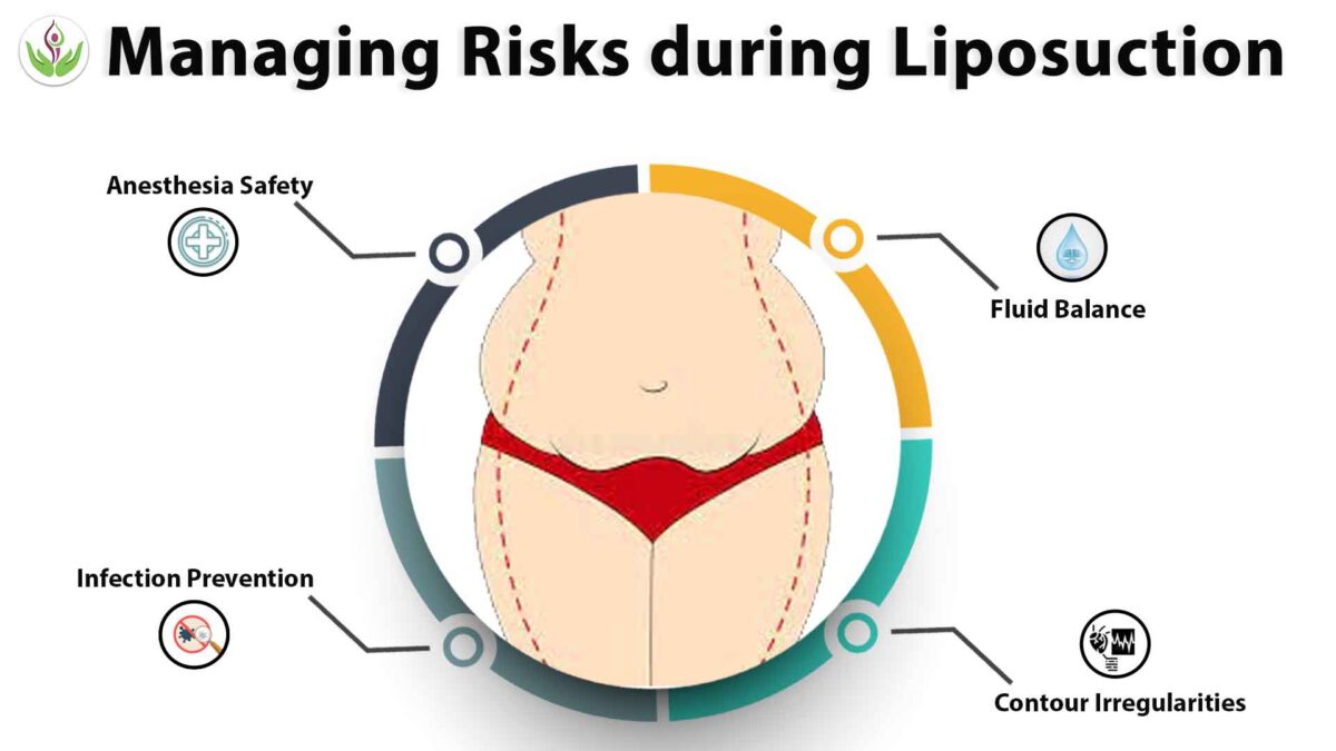 Managing Risks during Liposuction