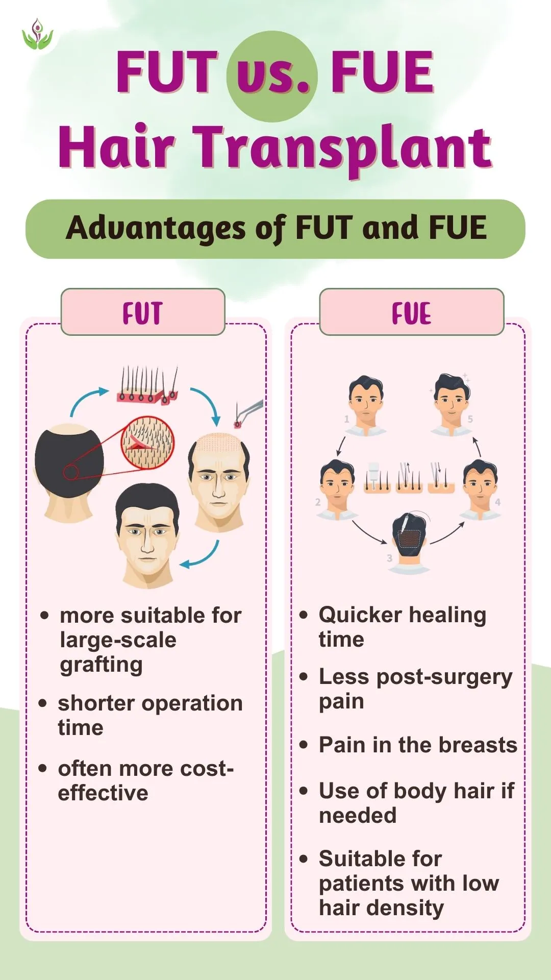 fut vs fue comparison