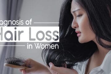 Diagnosis of Hair Loss in Women
