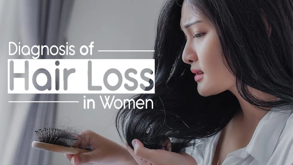 Diagnosis of Hair Loss in Women