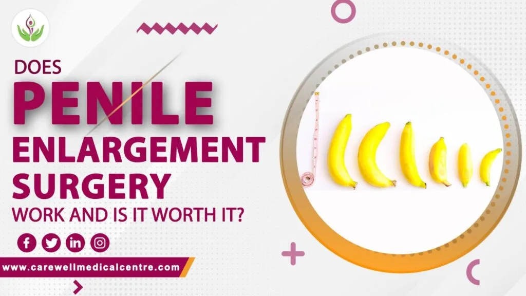 Does Penile Enlargement Surgery Work and Is It Worth It?