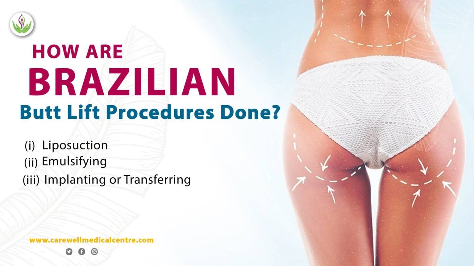 What Is a Brazilian Butt Lift Surgery? | Care Well Medical Centre