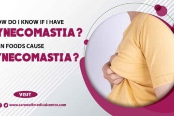 How do I know if I have Gynecomastia? Can Foods Cause Gynecomastia?