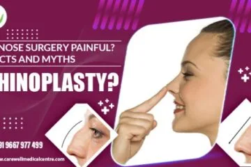 Is Nose Surgery Painful? Facts And Myths