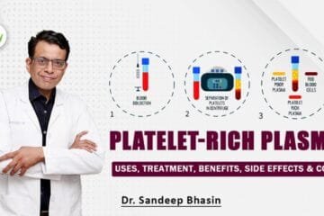 Platelet-Rich Plasma (PRP) Injection: Uses, Treatment, Benefits, Side Effects & Cost