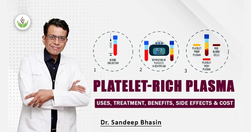 Platelet-Rich Plasma (PRP) Injection: Uses, Treatment, Benefits, Side Effects & Cost