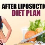What Should Be Our Diet Plan After Liposuction?