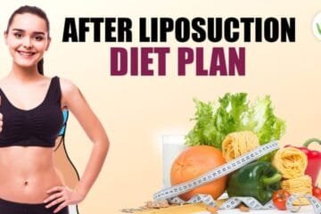 What Should Be Our Diet Plan After Liposuction?