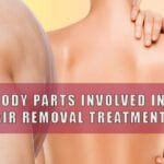 What Body Parts Involved in Laser Hair Removal Treatment?