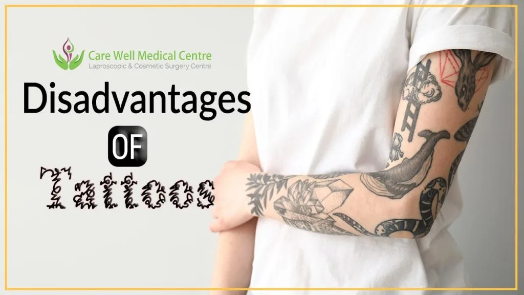 Disadvantages Or Health Risk Associated With Tattoos