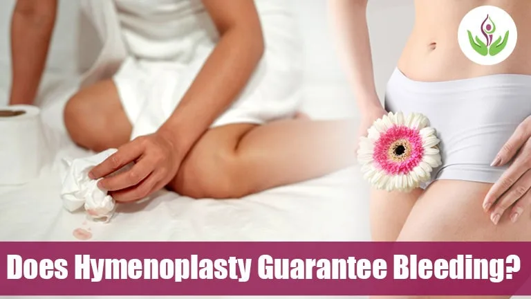 Does Hymenoplasty Guarantee Bleeding?