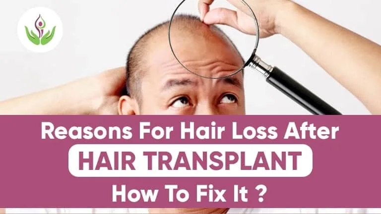 Know Reasons For Hair Loss After Hair Transplant – How To Fix It?