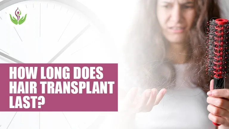 How Long Does Hair Transplant Last?