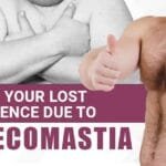 Regaining Confidence After Gynecomastia: How-To Guide
