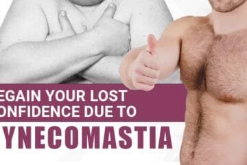 Regaining Confidence After Gynecomastia: How-To Guide