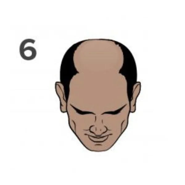 Norwood 6