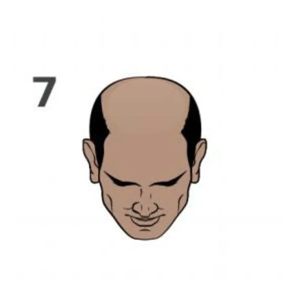 Norwood 7