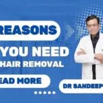 10 Reasons Why You Need Laser Hair Removal