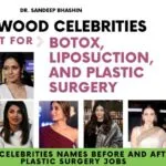 Bollywood Celebrities Who Use Botox, Liposuction & Plastic surgery