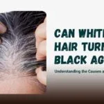 Can White Hair Turn Black Again