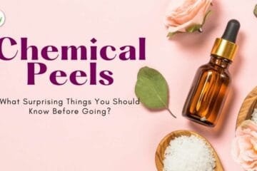 Chemical Peels: What Surprising Things You Should Know Before Go?