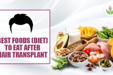 Best Foods (Diet) To Eat After Hair Transplant