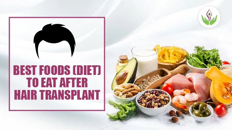 Best Foods (Diet) To Eat After Hair Transplant