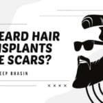 Do Beard Hair Transplants Leave Scars?
