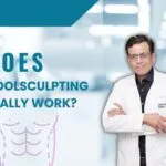 Does CoolSculpting Really Work?