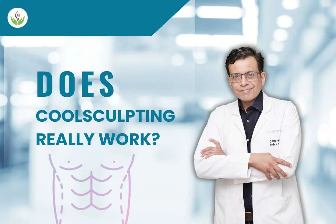 Does CoolSculpting Really Work?