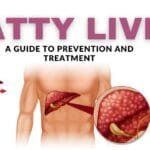 Fatty Liver a Guide to Prevention and Treatment