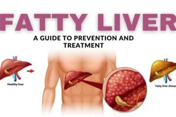 Fatty Liver a Guide to Prevention and Treatment