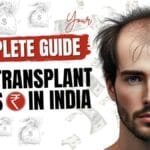 Hair Transplant Cost in India