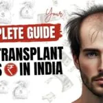 Hair Transplant Cost in India