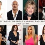 Hollywood Celebrities Who Have Undergone Liposuction
