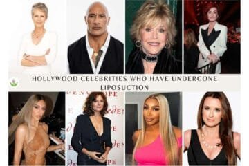 Hollywood Celebrities Who Have Undergone Liposuction