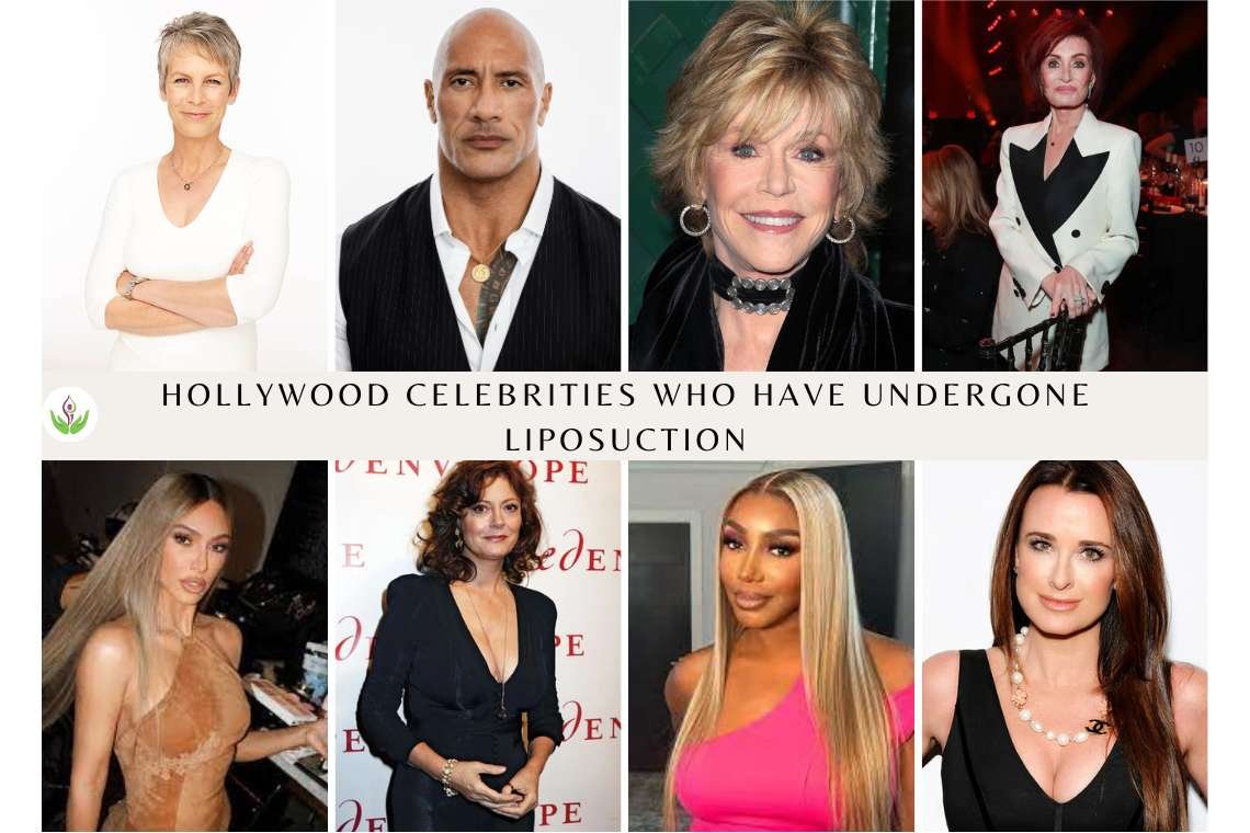 Hollywood Celebrities Who Have Undergone Liposuction