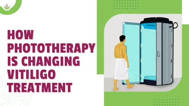 How Phototherapy Is Changing Vitiligo Treatment?