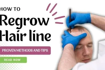 How to Regrow Hairline?